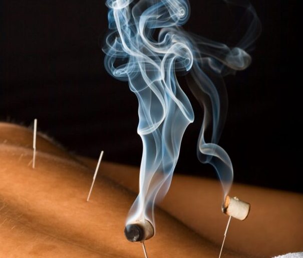 Herb, Acu, ST Images for MovingQi moxa burning on the end of an acupuncture needle